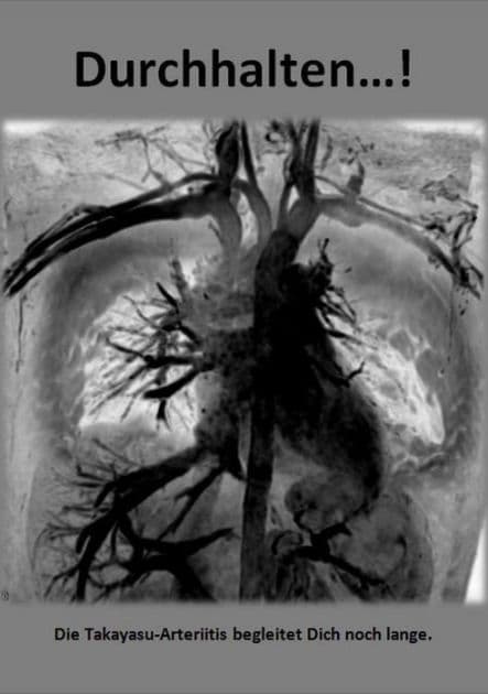 Durchhalten...!: Die Takayasu-Arteriitis begleitet Dich noch lange. by Stefanie Münsterer