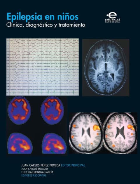 Epilepsia en niños: Clínica, diagnóstico y tratamiento by Varios autores