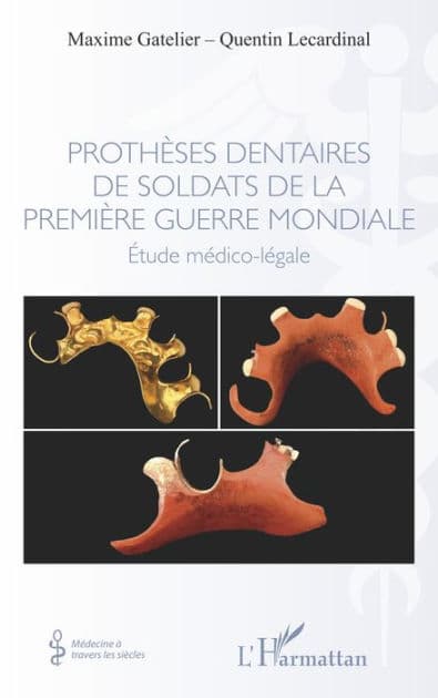 Prothèses dentaires de soldats de la Première Guerre Mondiale: Etude médico-légale by Maxime Gatelier