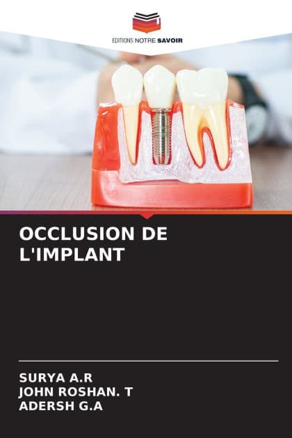 Occlusion de l'Implant by Surya A R