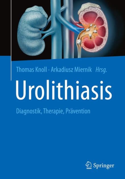 Urolithiasis: Diagnostik, Therapie, Prï¿½vention by Thomas Knoll