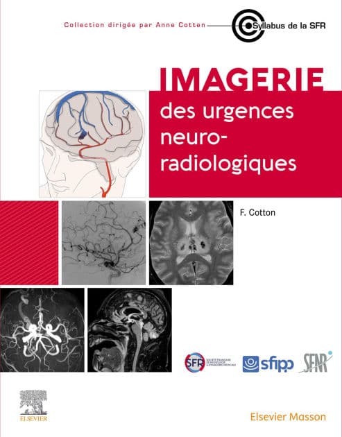 Imagerie des urgences neuroradiologiques by François Cotton