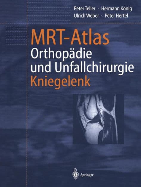 MRT-Atlas Orthopädie und Unfallchirurgie: Kniegelenk by Peter Teller