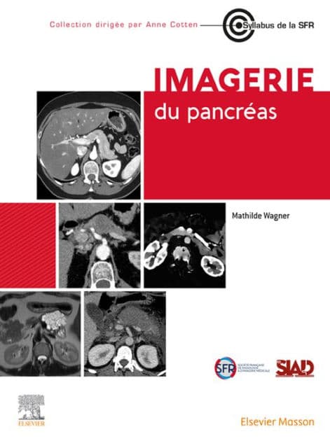 Imagerie du pancréas by Mathilde Wagner