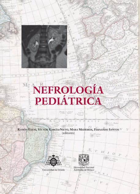 Nefrología pediátrica by Víctor García Nieto
