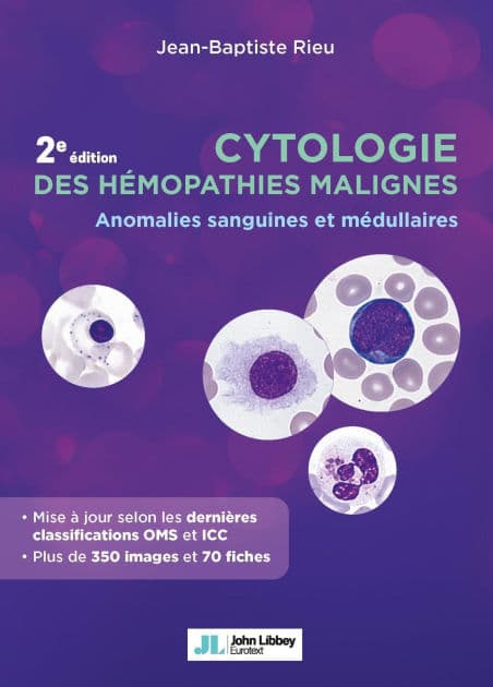Cytologie des hémopathies malignes (2e édition): Anomalies sanguines et médullaires by Jean-Baptiste Rieu