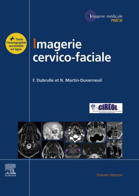 Imagerie cervicofaciale: Massif facial - Sinus - Voies aérodigestives supérieures - Pathologies cervicales - Espaces profonds de la face by Frédérique Dubrulle