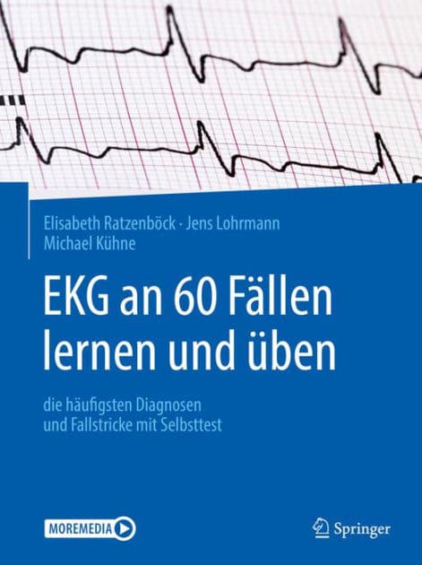 EKG an 60 Fï¿½llen lernen und ï¿½ben: die hï¿½ufigsten Diagnosen und Fallstricke mit Selbsttest by Elisabeth Ratzenbïck