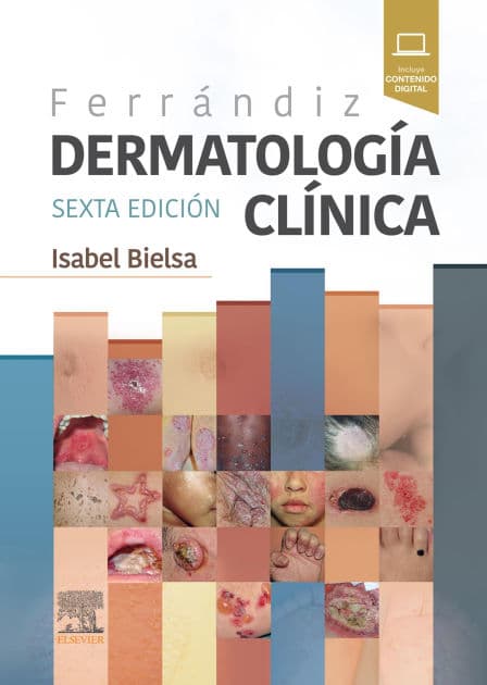 Ferrándiz. Dermatología clínica by Isabel Bielsa Marsol