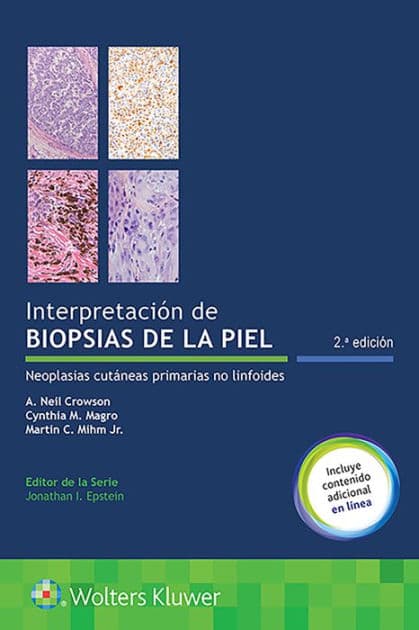 Interpretación de biopsias de la piel: Neoplasias cutáneas primarias no linfoides / Edition 2 by A. Neil Crowson MD, Cynthia M. Magro MD, Martin C. Mihm Jr., MD