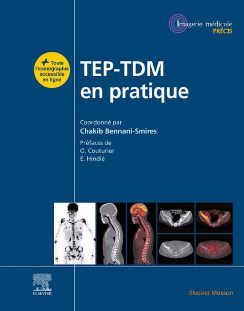 TEP-TDM en pratique by Chakib Bennani Smires