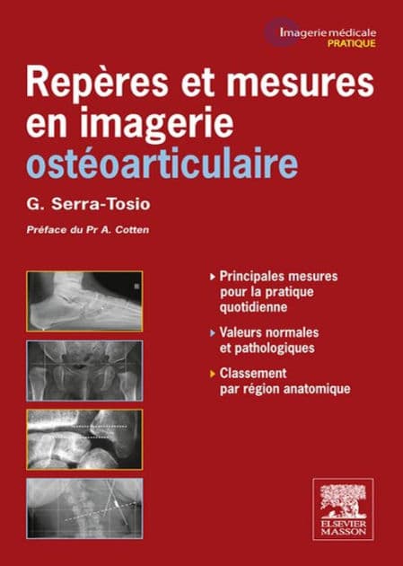 Repères et mesures en imagerie ostéo-articulaire by Géraldine Serra-Tosio
