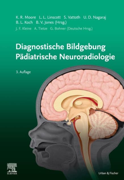 Diagnostic Imaging: Pädiatrische Neuroradiologie: Diagnostic Imaging: Pädiatrische Neuroradiologie by Kevin R Moore
