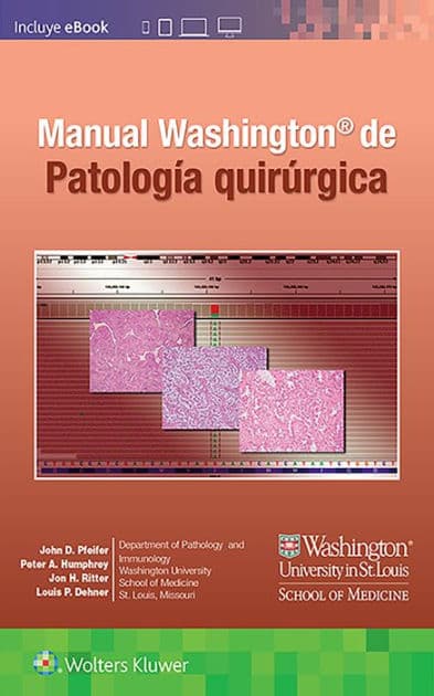 Manual Washington de patología quirúrgica by John D. Pfeifer MD