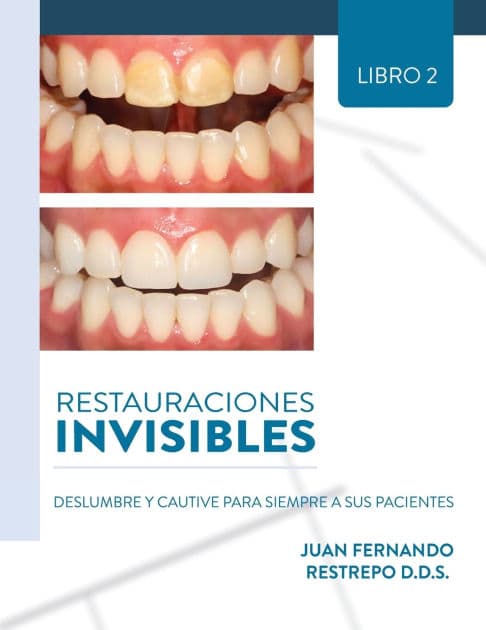 Restauraciones Invisibles: Deslumbre Y Cautive Para Siempre A Sus Pacientes by Juan Fernando Restrepo