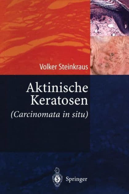 Aktinische Keratosen (Carcinomata in situ) by Volker Steinkraus