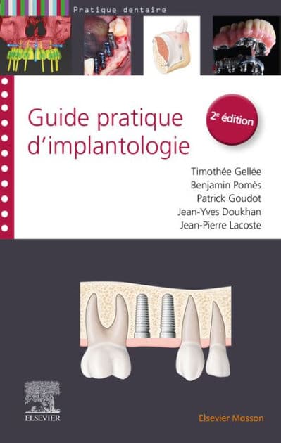Guide pratique d'implantologie by Benjamin Pomès