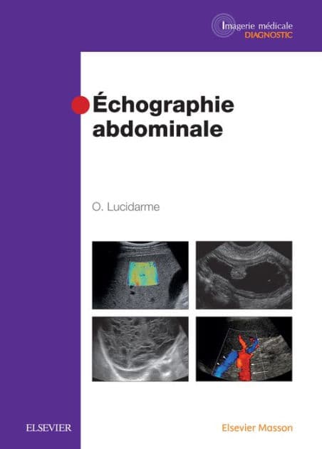 Echographie abdominale by Olivier Lucidarme
