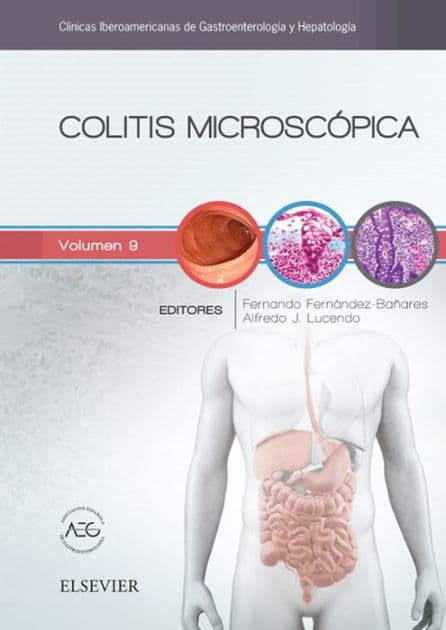 Colitis microscópica: Clínicas Iberoamericanas de Gastroenterología y Hepatología vol.9 by Fernando Fernández-Bañares
