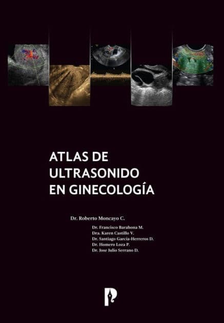 Atlas de ultrasonido en ginecología by Roberto Moncayo