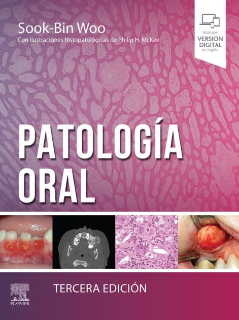 Patología oral by MMSc Woo DMD