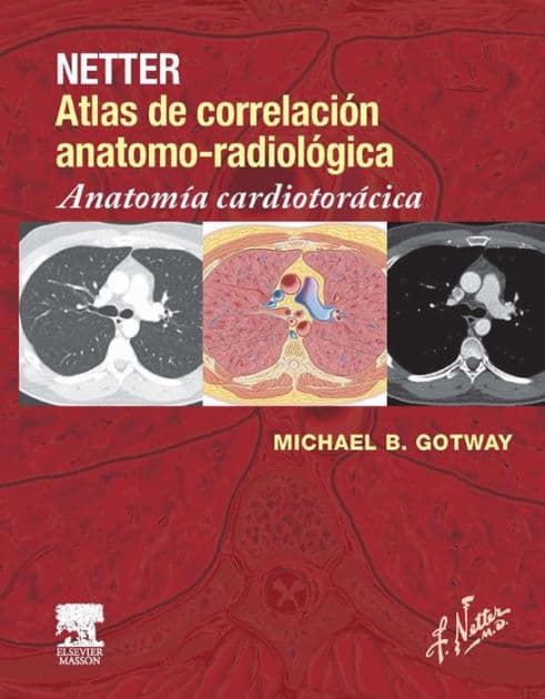 Netter. Atlas de correlación anatomo-radiológica: Anatomía cardiotorácica by Michael B. Gotway MD