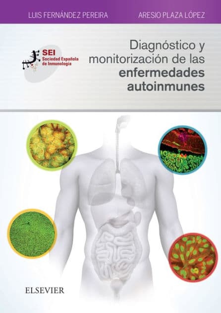 Diagnóstico y monitorización de las enfermedades autoinmunes: Sociedad Española de Inmunología by Luis Fernández Pereira
