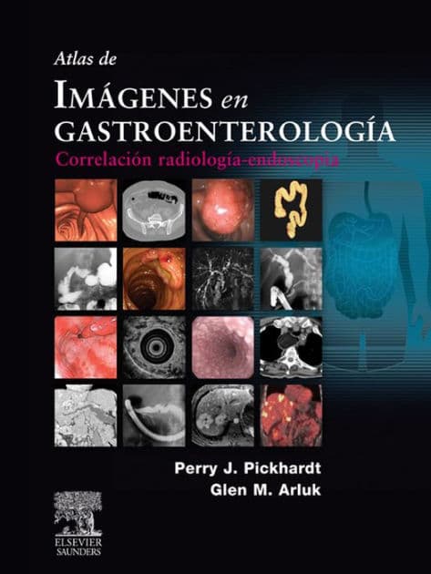 Atlas de imágenes en gastroenterología: Correlación radiología-endoscopia by Perry J. PICKHARDT