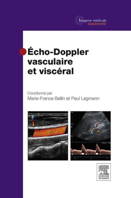 Echo-Doppler vasculaire et viscéral by Marie-France Bellin