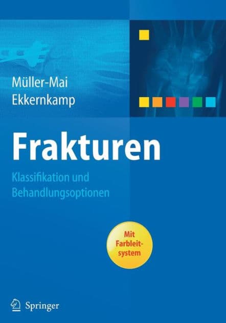 Frakturen: Klassifikation und Behandlungsoptionen by Christian Müller-Mai