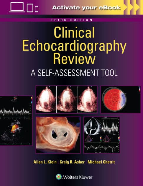 Clinical Echocardiography Review: A Self-Assessment Tool: Print + eBook with Multimedia by Allan L. Klein MD