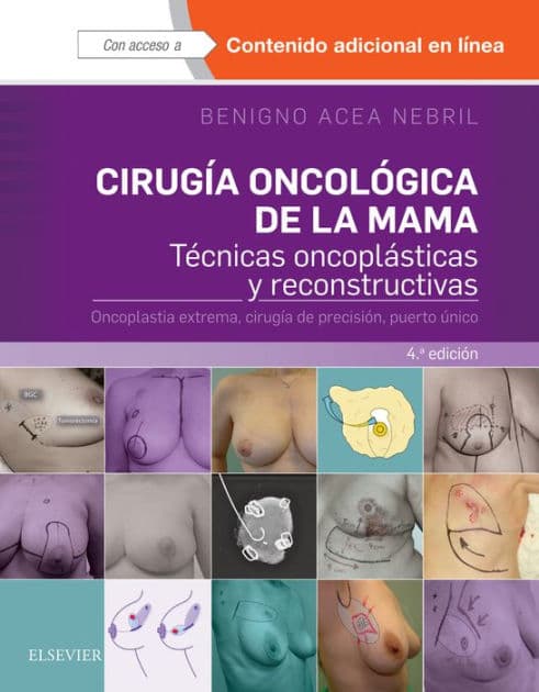Cirugía oncológica de la mama: Técnicas oncoplásticas y reconstructivas. Oncoplastia extrema, cirugía de precisión, puerto único by Benigno Acea Nebril