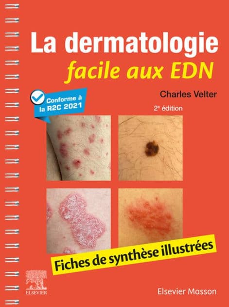 La dermatologie facile aux EDN: Fiches de synthèse illustrées by Charles Velter