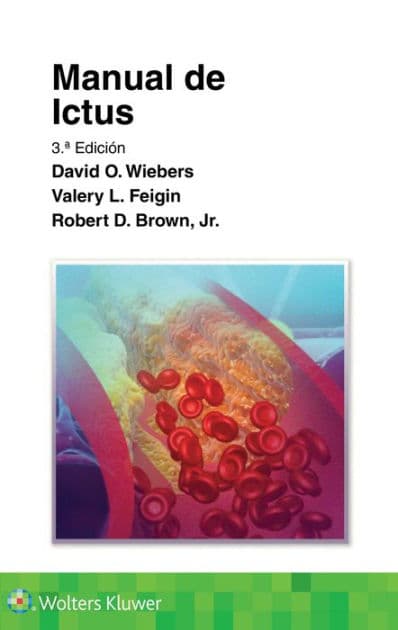 Manual de ictus by David O. Wiebers