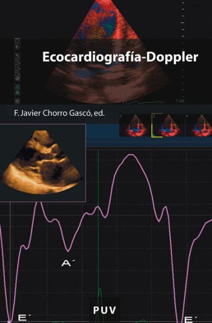 Ecocardiografía-Doppler by Autores Varios