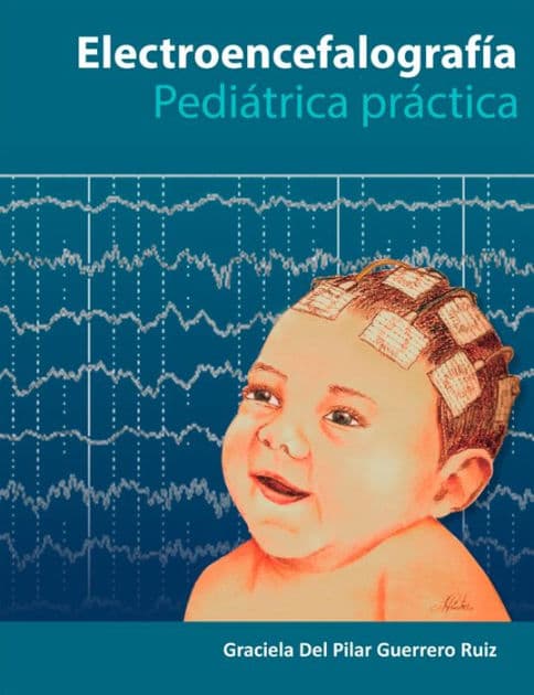 Electroencefalografía Pediatría Práctica by Graciela Del Pilar Guerrero Ruiz