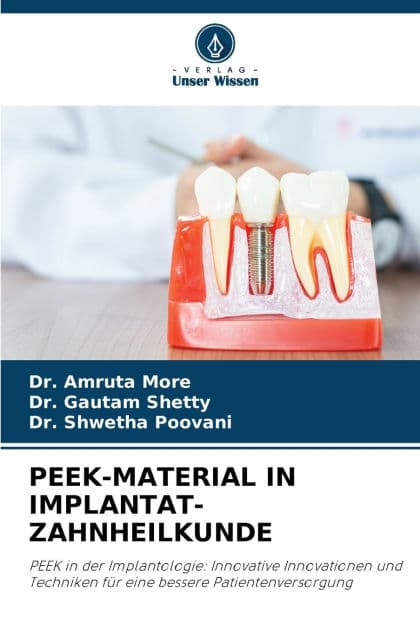 Peek-Material in Implantat-Zahnheilkunde by Amruta More