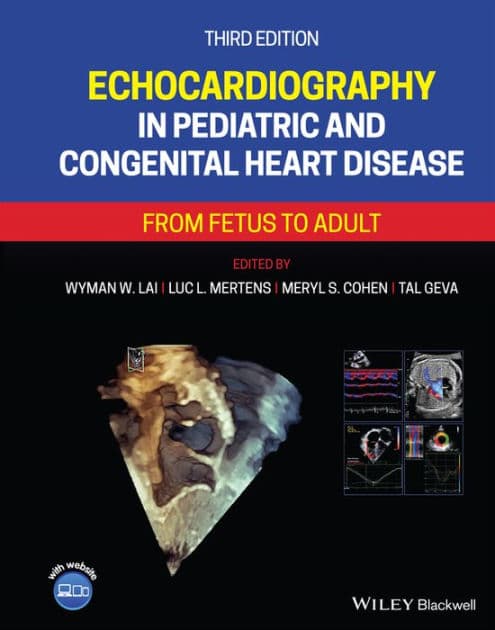 Echocardiography in Pediatric and Congenital Heart Disease: From Fetus to Adult by Wyman W. Lai
