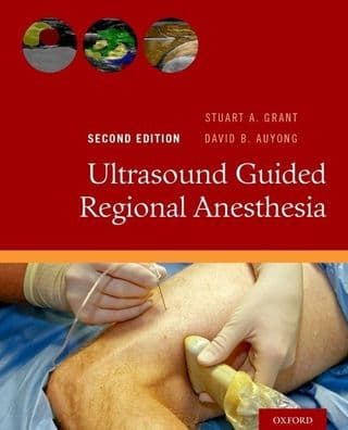 Ultrasound Guided Regional Anesthesia by Stuart A. Grant