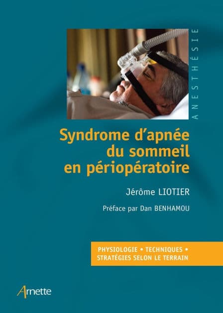 Syndrome d'apnée du sommeil en périopératoire: Physiologie Techniques Stratégies selon le terrain by Jérôme Liotier