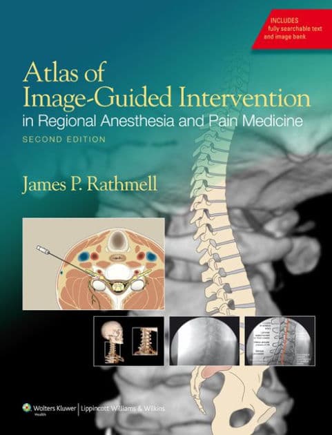 Atlas of Image-Guided Intervention in Regional Anesthesia and Pain Medicine by James P. Rathmell MD