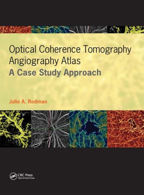 Optical Coherence Tomography Angiography Atlas: A Case Study Approach by Julie Rodman