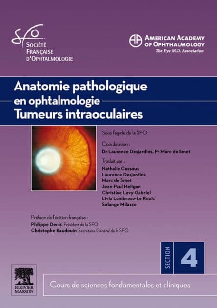 Anatomie pathologique en ophtalmologie. Tumeurs intraoculaires by American Academy of Ophthalmology (AAO)