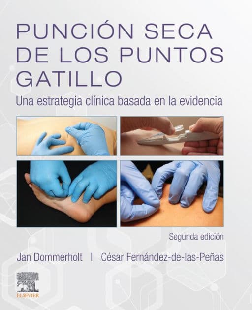 Punción seca de los puntos gatillo by DPT Dommerholt PT