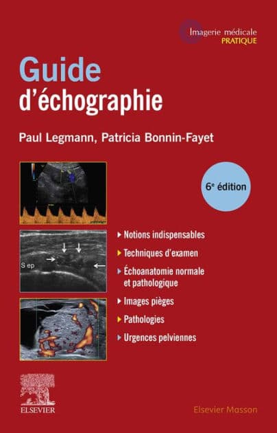 Guide pratique d'échographie by Paul Legmann
