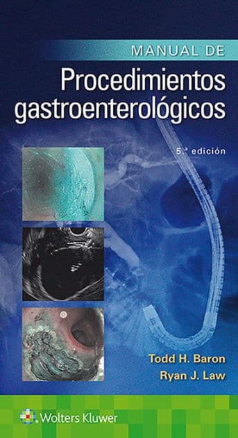 Manual de procedimientos gastroenterológicos by Todd Huntley Baron