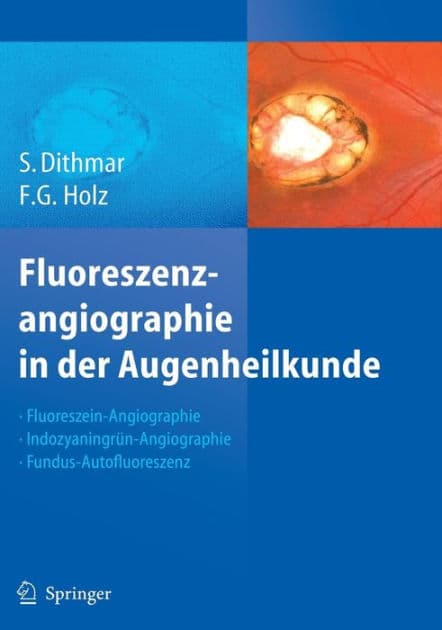 Fluoreszenzangiographie in der Augenheilkunde: Fluoreszein-Angiographie, Indozyaningrün-Angiographie und Fundus-Autofluoreszenz by Stefan Dithmar