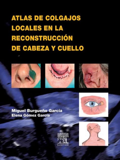Atlas de colgajos locales en la reconstrucción de cabeza y cuello by Miguel Burgueño García