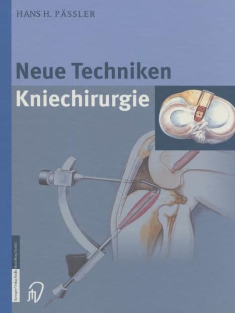 Neue Techniken Kniechirurgie by H.H. Pïssler
