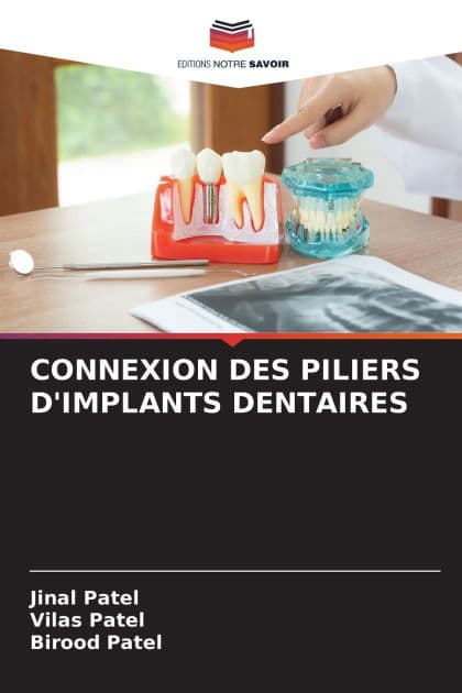 Connexion Des Piliers d'Implants Dentaires by Jinal Patel